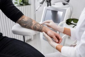 Profesional valorando un antebrazo tatuado antes de una sesión de eliminación con láser